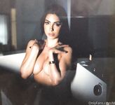 Anonymiss onlyfans album