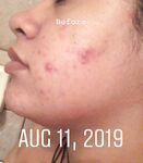 Bbytriste liltriste Myla Tristebby Tristeluna XXX Photos