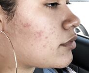 Bbytriste liltriste Myla Tristebby Tristeluna XXX Photos