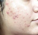 Bbytriste liltriste Myla Tristebby Tristeluna XXX Photos